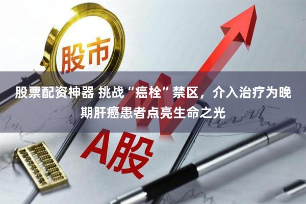 股票配资神器 挑战“癌栓”禁区，介入治疗为晚期肝癌患者点亮生命之光